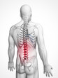 3d rendered illustration - backache