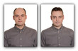 Bald man with a Wig.