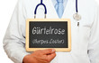 Gürtelrose - Herpes Zoster
