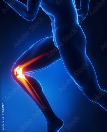 Illustration: Running man knee anatomy Running man knee anatomy