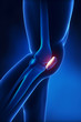 Patella anatomy lateral view