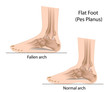 Flat foot, eps10
