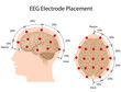 EEG electrode placement, eps10