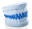 individual plaster dental molds to make trays