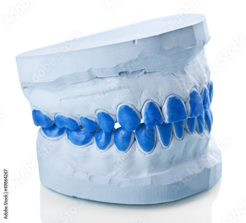 Photo: individual plaster dental molds to make trays individual plaster dental molds to make trays