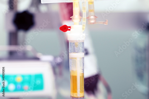 Photo: Transfusion of human plasma in hospital Transfusion of human plasma in hospital