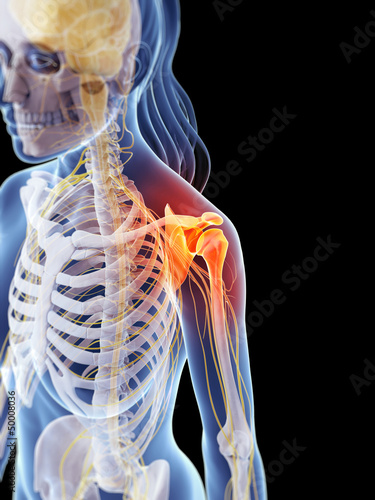 Illustration: 3d rendered illustration of a painful shoulder 3d rendered illustration of a painful shoulder