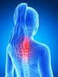 3d rendered illustration of a painful neck