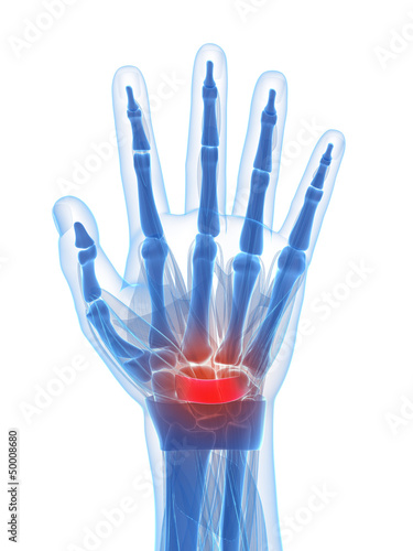 Illustration: 3d rendered illustration of the carpal tunnel syndrome 3d rendered illustration of the carpal tunnel syndrome