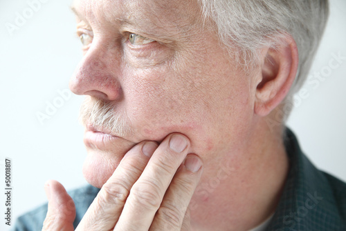 Photo: older man with a red, itchy rash on his cheek older man with a red, itchy rash on his cheek