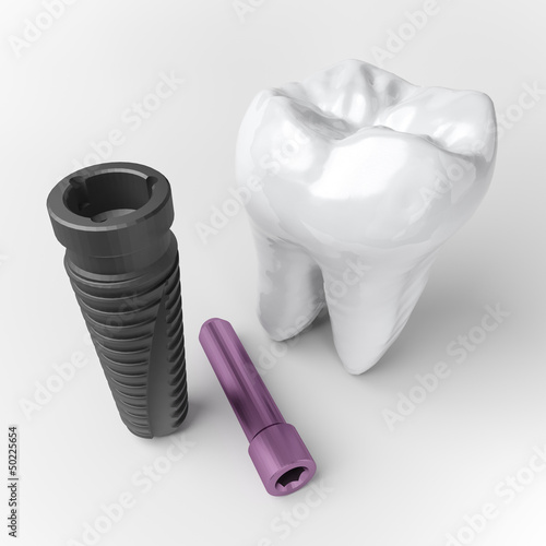 Illustration: zahn implantat zahn implantat