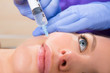 Foto: Anti aging facial mesotherapy syringe on woman face Anti aging facial mesotherapy syringe on woman face