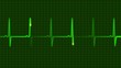 electrocardiograms