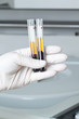 Woman loading samples in biochemical analyzer