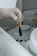Woman loading samples in biochemical analyzer