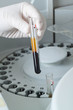 Woman loading samples in biochemical analyzer