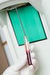 Woman performin hematological test.
