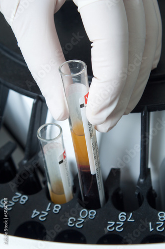 Photo: Woman loading samples in analyzer Woman loading samples in analyzer