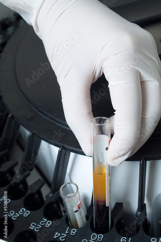 Photo: Woman loading samples in analyzer Woman loading samples in analyzer