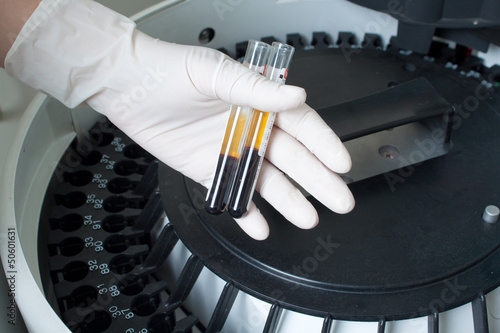 Photo: Woman loading samples in analyzer Woman loading samples in analyzer