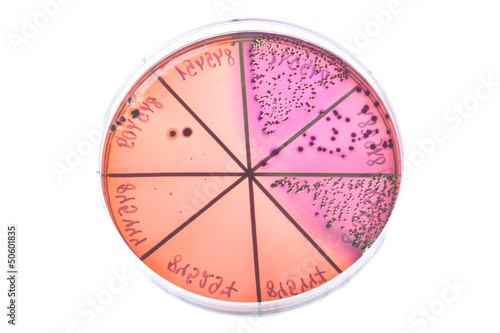 Photo: Bacteria on petri dish Bacteria on petri dish