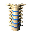 Cervical Spine - Anterior / Front view