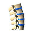 Lumbar Spine - Lateral view / Side view
