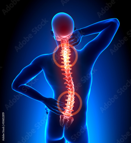 Illustration: Male Hurt Backbone - Vertebrae Pain Male Hurt Backbone - Vertebrae Pain