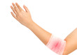 forearm and elbow injury ,strain ,sprained in white bandage