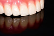 Photo: Dental prosthesis Dental prosthesis