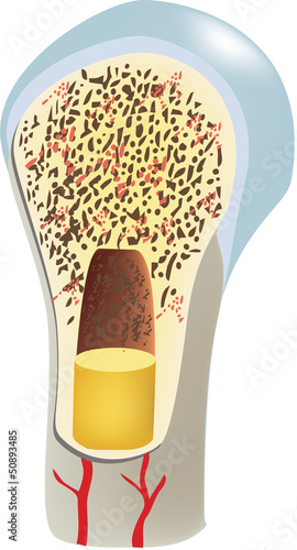 Vector: osteoporosi osteoporosi