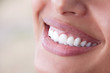 perfect teeth
