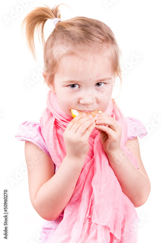Photo: Sick little girl with chickenpox eating lemon Sick little girl with chickenpox eating lemon