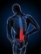 3d rendered illustration of a man having backache