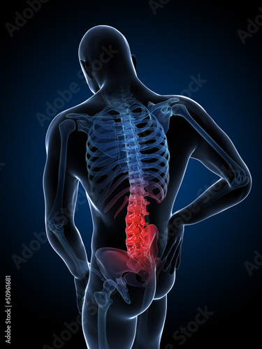 Illustration: 3d rendered illustration of a man having backache 3d rendered illustration of a man having backache