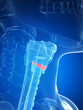 3d rendered illustration of the thyroid anatomy -
