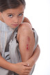 Little girl with grazed knee