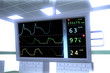 Operation Room EKG ECG monitor