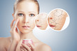 concept of cosmetic skin care.  face of young woman with dry ski