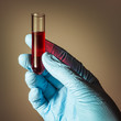 Blood tests - medical diagnostic tube with analysis