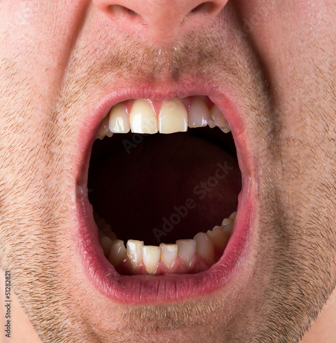Photo: Screaming mouth Screaming mouth