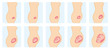 Gestation cycle