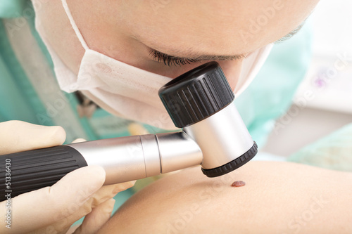 Photo: examines birthmark with dermatoscope examines birthmark with dermatoscope