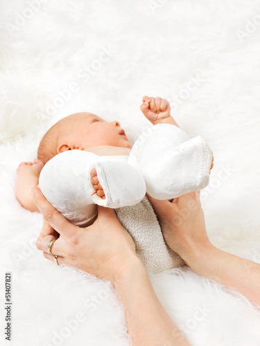Photo: Mother holding newborn baby's legs wrapped in bandage Mother holding newborn baby's legs wrapped in bandage