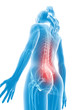 3d rendered medical illustration - backache