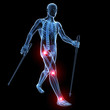 3d rendered medical illustration - painful joints