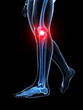 3d rendered medical illustration - painful knee