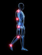 3d rendered medical illustration - painful joints