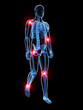 3d rendered medical illustration - painful joints