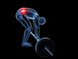 3d rendered medical illustration - wrong lifting posture